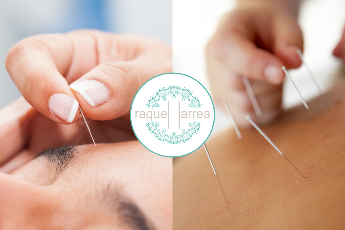 Práctica de lifting facial con acupuntura en la Escuela Raquel Larrea